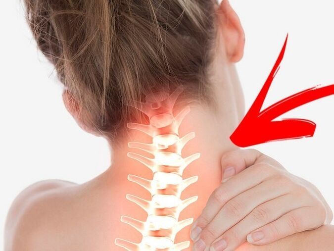 فشرده سازی ریشه های عصبی با پوکی استخوان گردن رحم