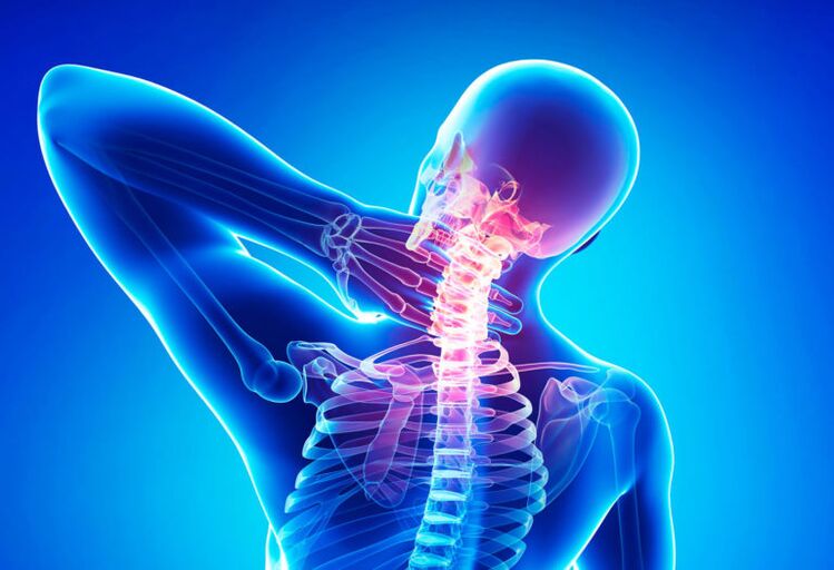 پوکی استخوان ستون فقرات گردن رحم