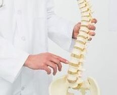 استئوکندروز کمر